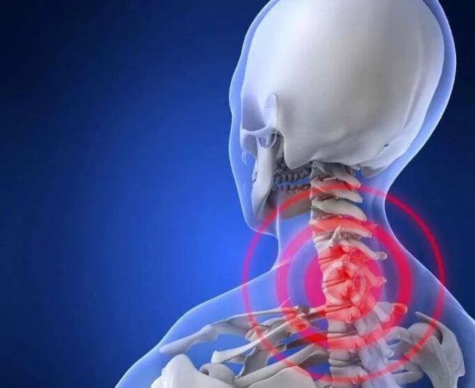 What is osteocondrosis