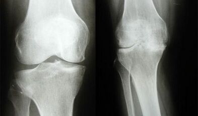 Knee diagnosis methods