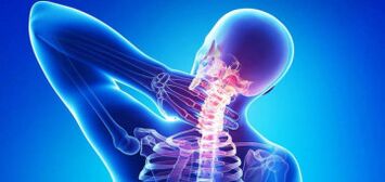 Causes of cervical osteocondrosis