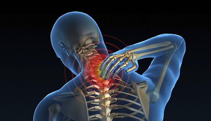 nerve in the spine as the cause of back pain