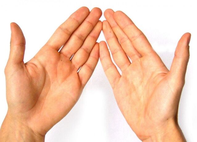 Rheumatoid arthritis affects the joints of the fingers due to the dysfunction of the immune system.