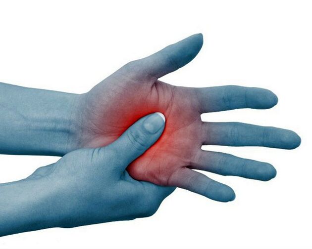 Severe pain in the joints of the fingers, which is relieved by exercise, is a typical symptom of rheumatoid arthritis.